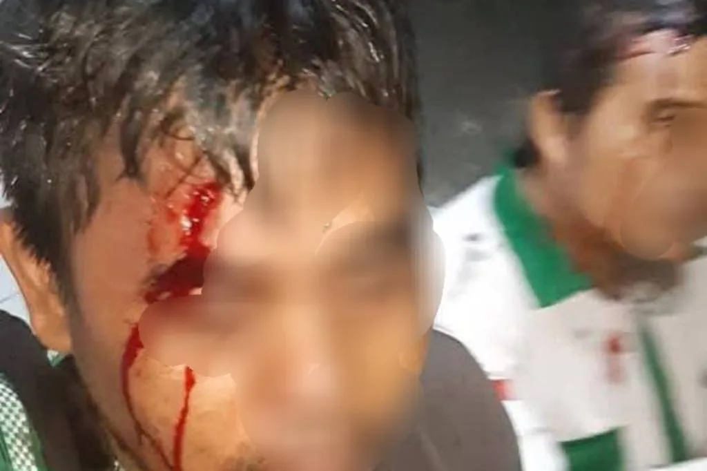 Tabliq Akbar Habib Rizieq Berujung Tawuran Medsos Diduga Picu Konflik Tabliq Akbar Habib Rizieq Berujung Tawuran: Medsos Diduga Picu Konflik