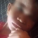 Bocah Gizi Buruk di Bekasi Meninggal Dunia, Keluarga Malah Terlilit Hutang Rumah Sakit