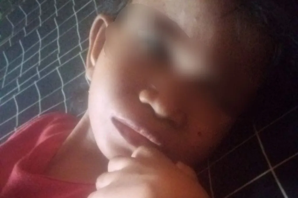 Bocah Gizi Buruk di Bekasi Meninggal Dunia, Keluarga Malah Terlilit Hutang Rumah Sakit