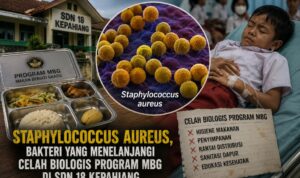 Staphylococcus Aureus, Bakteri yang Menelanjangi Celah Biologis Program MBG di SDN 18 Kepahiang
