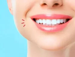 Tips Perawatan Alami Dan Aman Untuk Memutihkan Gigi Di Rumah