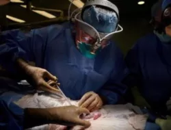 Usai Transplantasi Ginjal Babi, Wanita Asal New Jersey Meninggal Dunia 