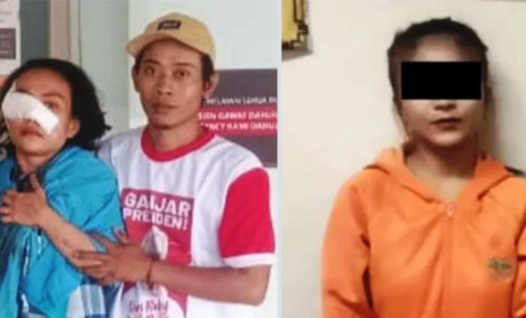 Terbakar Cemburu, Pemandu Karaoke Sabet Wajah Istri Mantan Kekasih